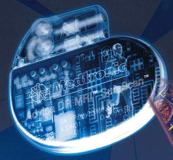 Imagen: El sistema de marcapasos Advisa DR MRI SureScan (Foto cortesía de Medtronic).